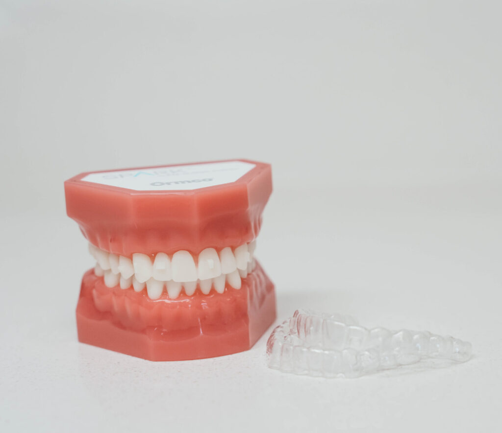 Model teeth wearing clear aligners, demonstrating Invisalign treatment at Prince Orthodontics in American Fork.