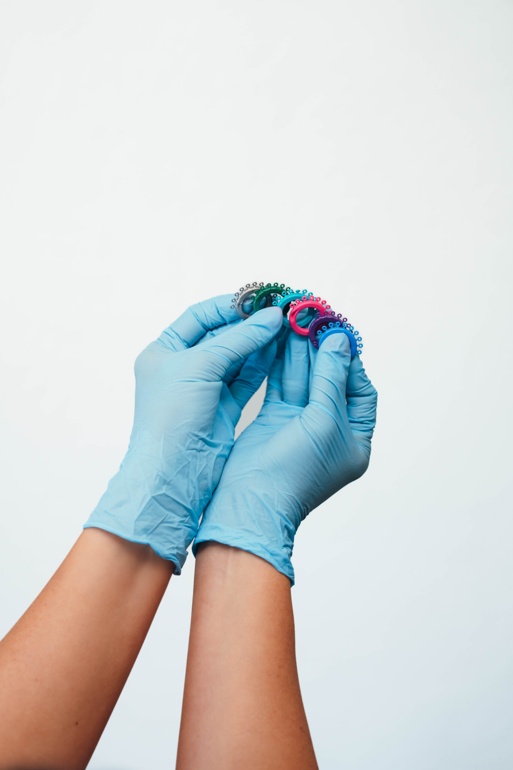 Prince Orthodontics teeth model of braces near American Fork, Utah