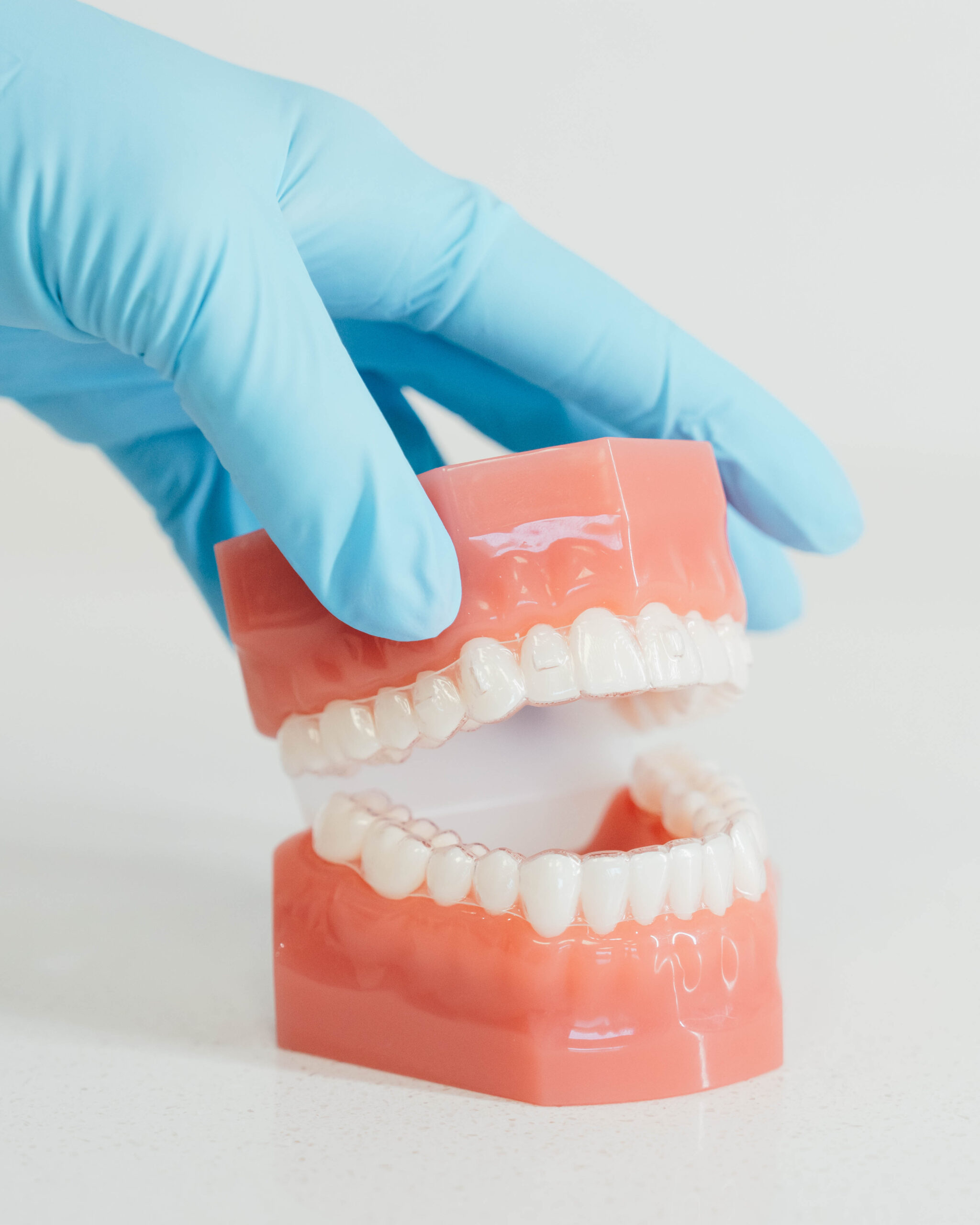 Prince Orthodontics teeth model of clear aligners near American Fork, Utah