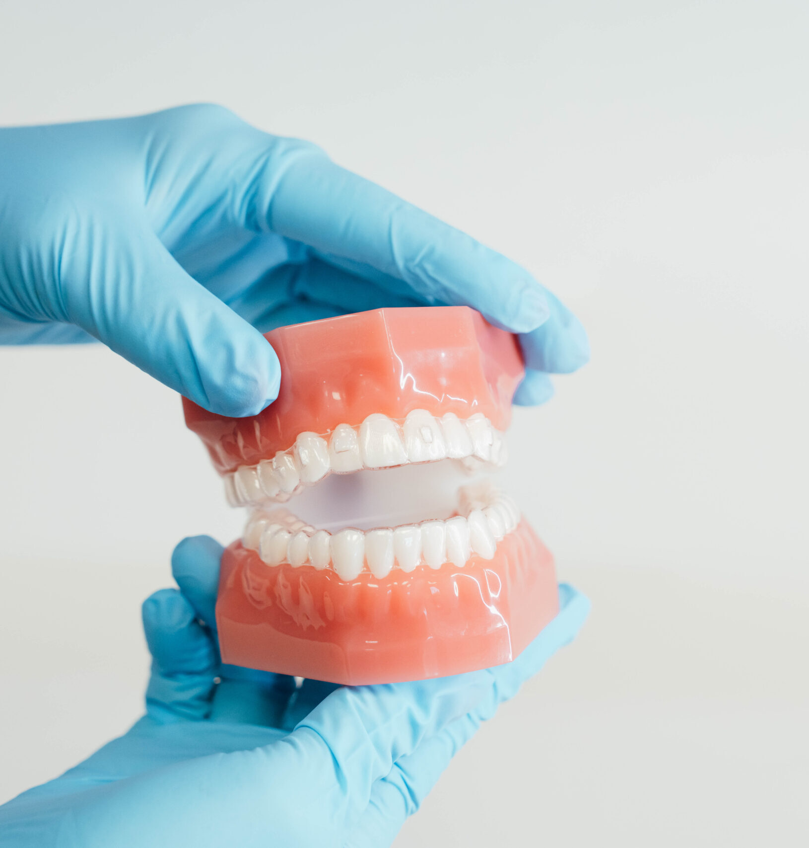 Prince Orthodontics teeth model of clear aligners near American Fork, Utah