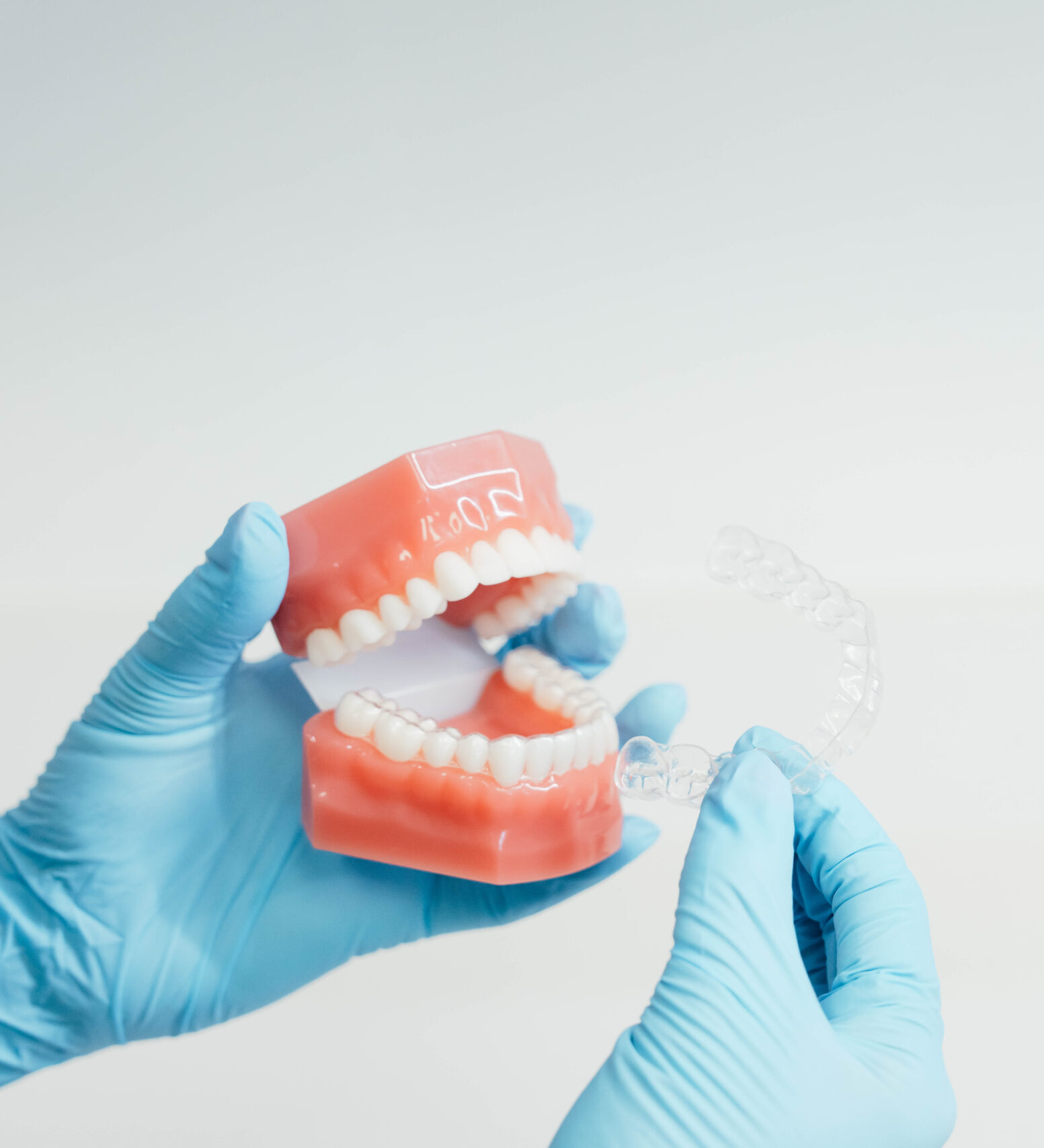 Prince Orthodontics teeth model of clear aligners and invisalign