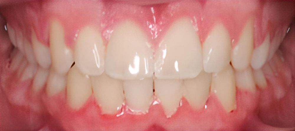 prince-orthodontics-gallery-04-after-1920w