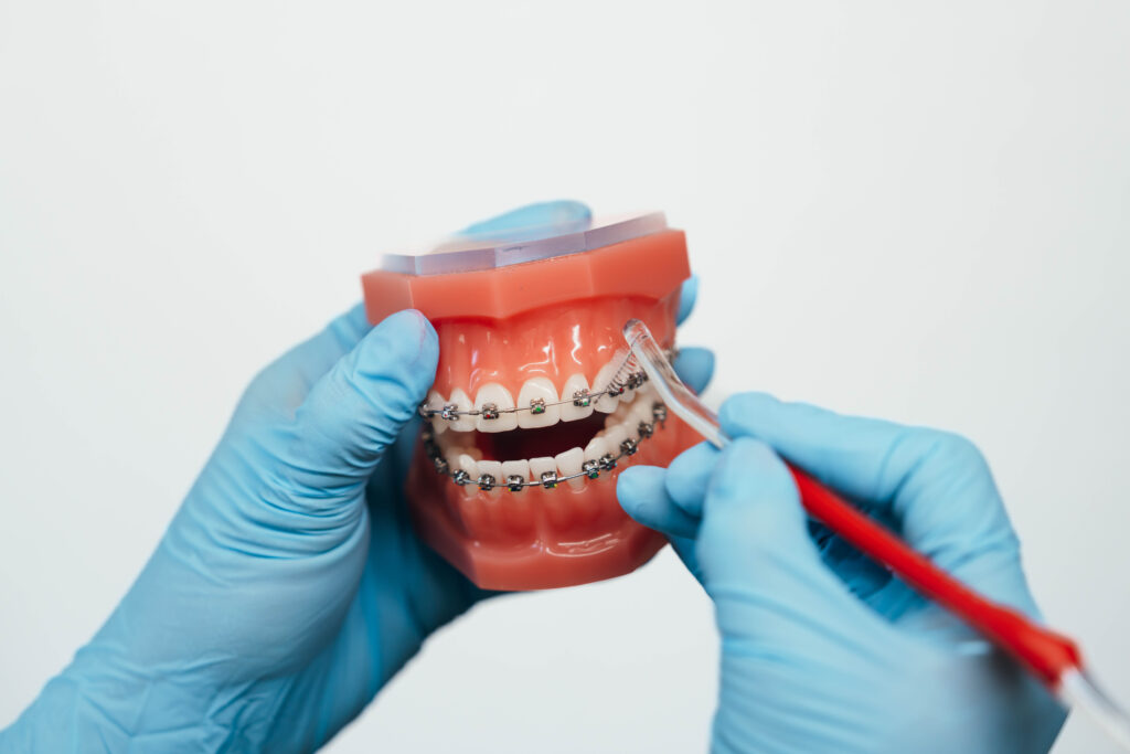 Prince Orthodontics in American Fork demonstrating that braces don't have to hurt