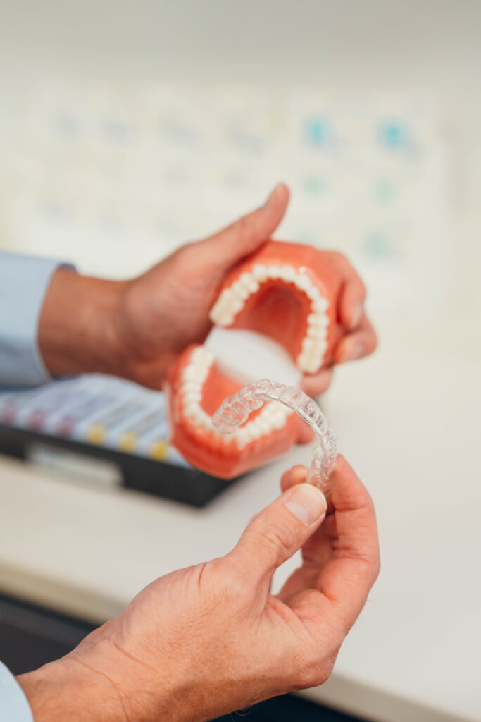 Retainers being demonstrated on teeth.