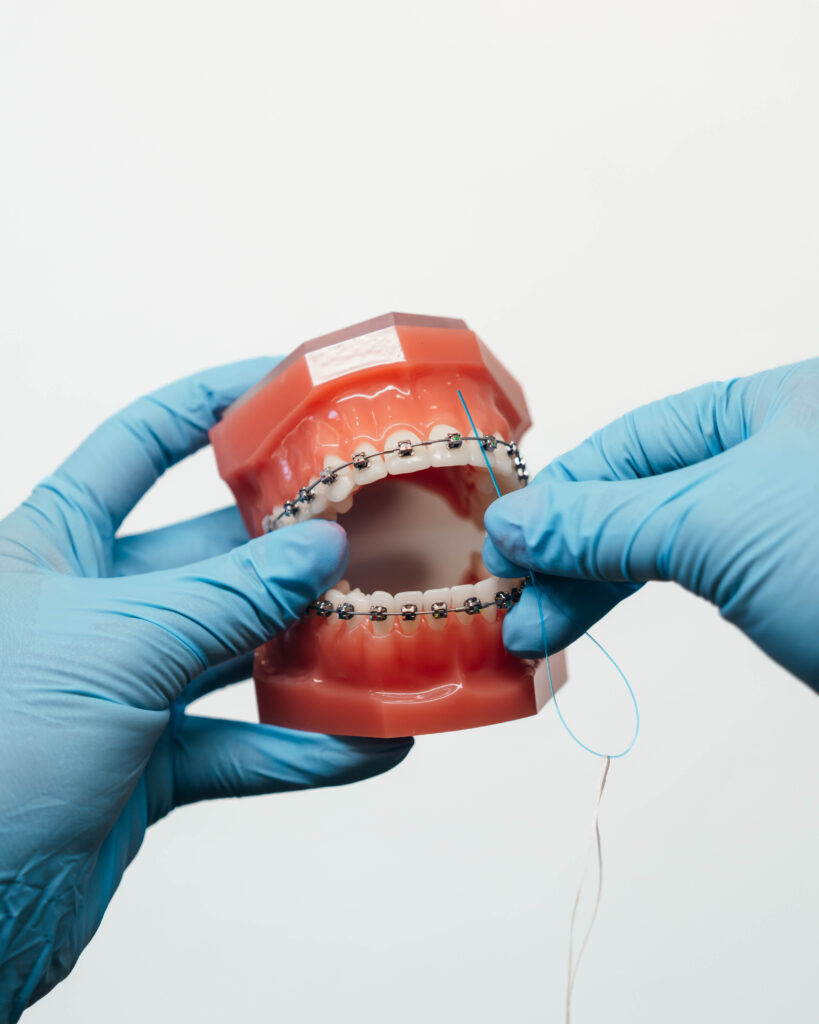 A depiction of flossing with braces.