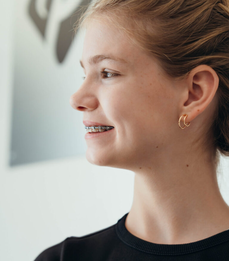 Teen patient smiling with metal braces during orthodontic treatment at Prince Orthodontics, showing improved tooth alignment and a confident smile.