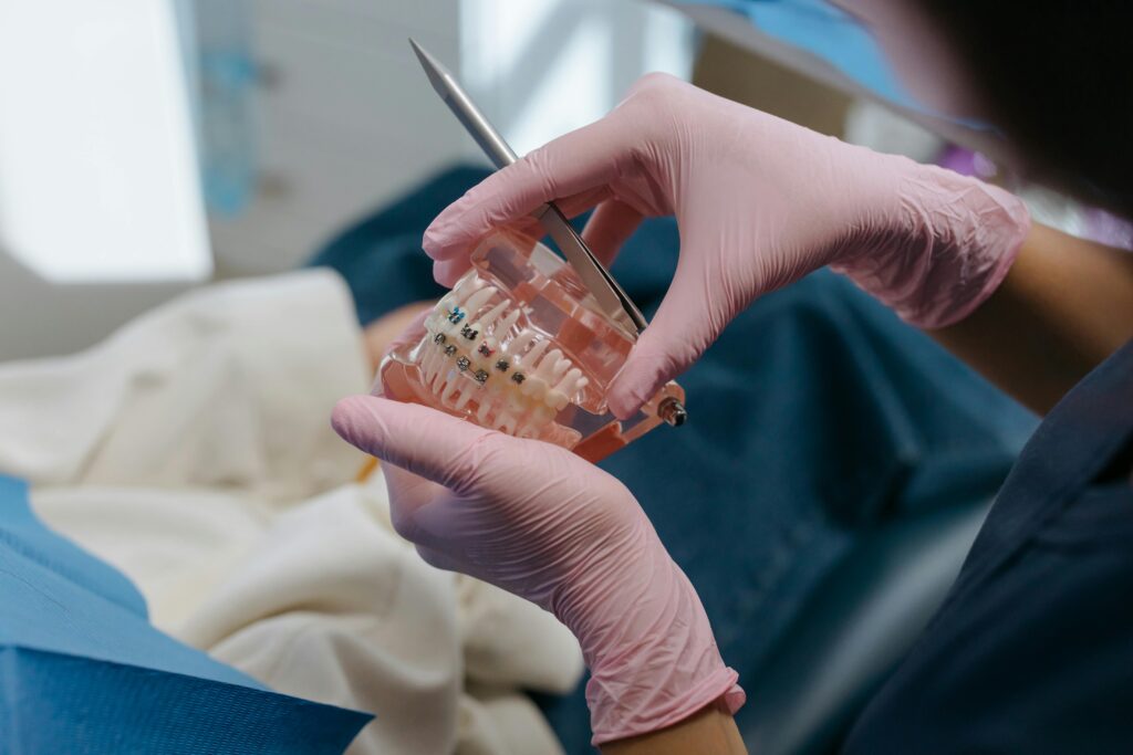 Orthodontist holding dental model with metal braces showing treatment options for crowded teeth.
