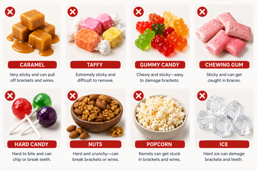 Illustrated guide showing foods to avoid with braces, including caramel, taffy, gummy candy, chewing gum, hard candy, nuts, popcorn, and ice that can damage brackets and wires.