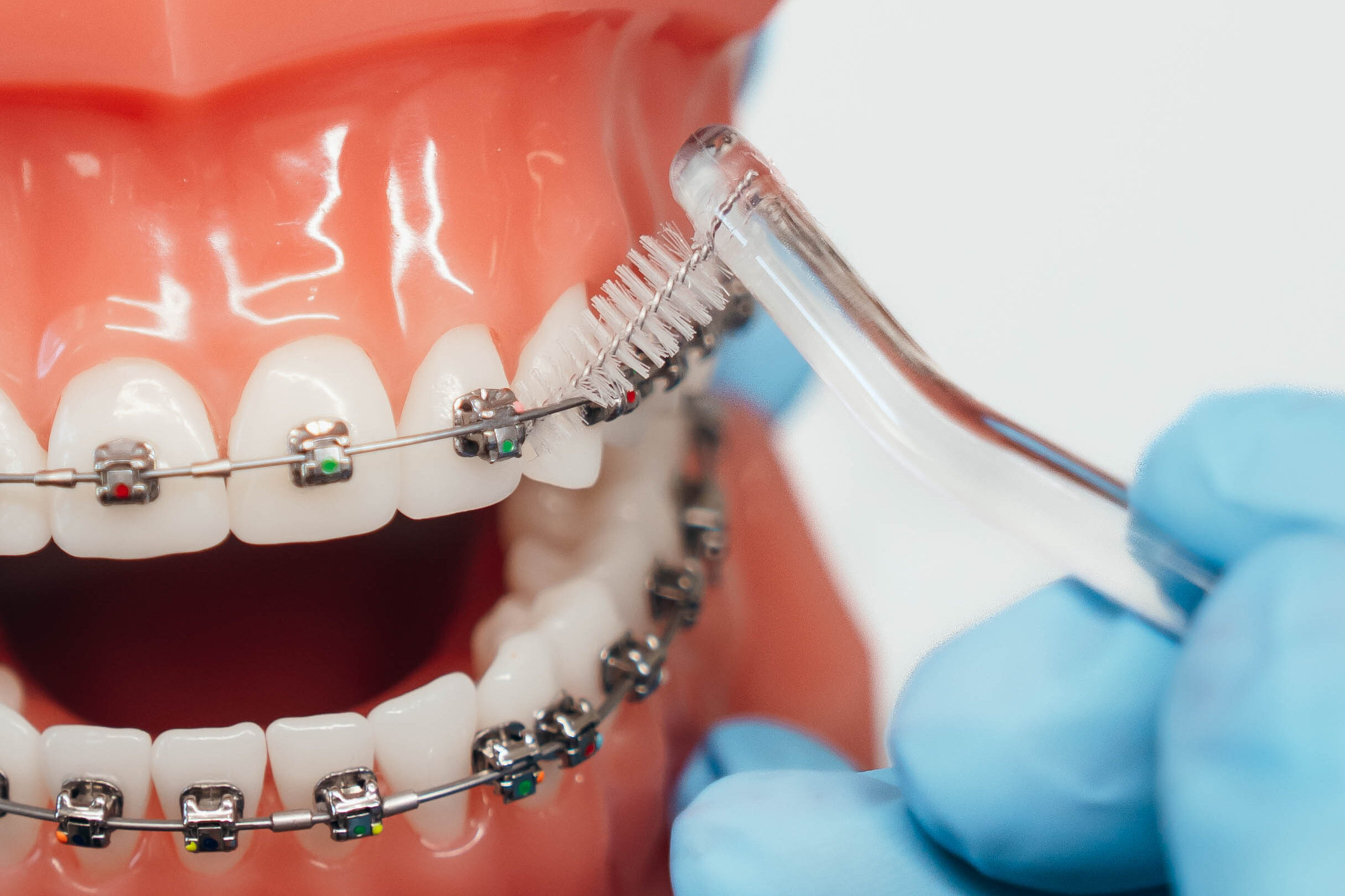 Orthodontist cleaning braces on a dental model at Prince Orthodontics in American Fork, UT.
